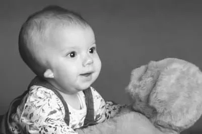 Baby with microtia hugging a teddy bear