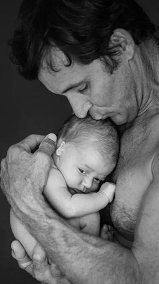 Dad with a baby with microtia