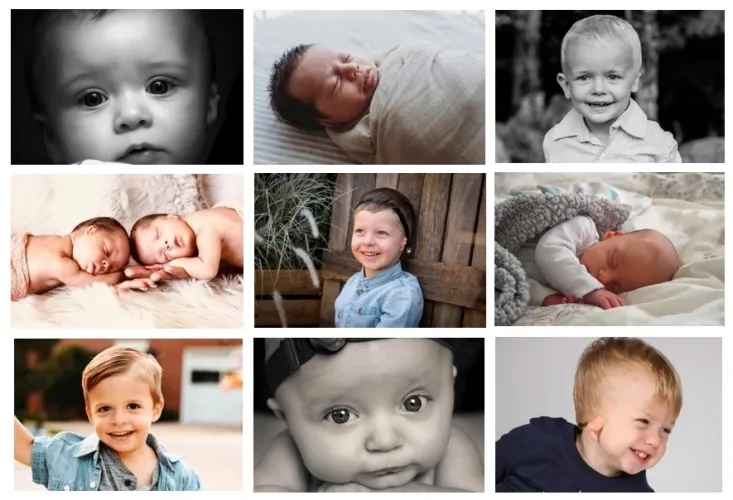 Nine images of children with microtia and atresia