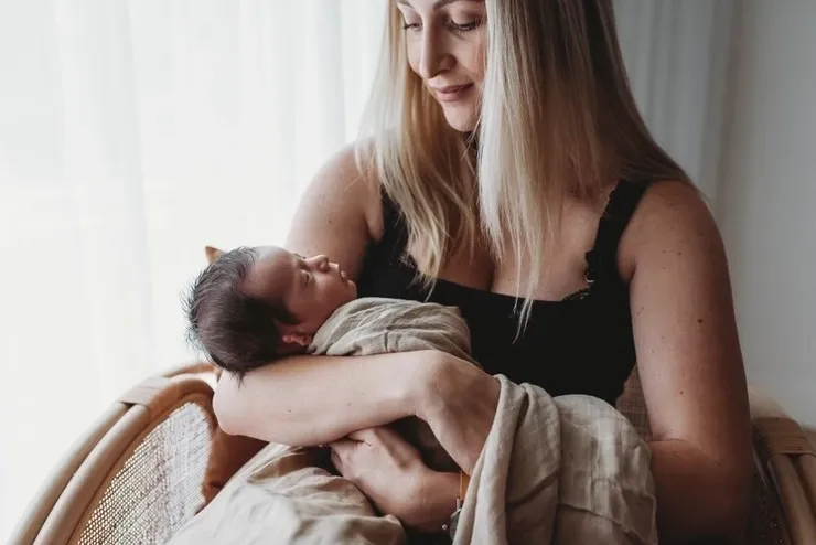 Mother holding a baby with microtia