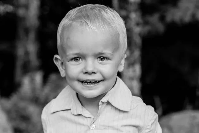 Black and white photo of boy with microtia